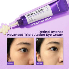 SOME BY MI Retinol Intense Advanced Triple Action Eye Cream 30ml - Yuki Skin